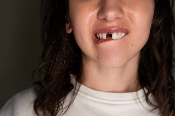 A Hole in the Front Tooth Dream in Islam